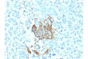 Immunohistochemistry (IHC) image for anti-Nerve Growth Factor Receptor (NGFR) (AA 281-421) antibody (ABIN6940196)