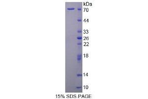 SDS-PAGE (SDS) image for Signal Transducing Adaptor Molecule (SH3 Domain and ITAM Motif) 2 (STAM2) (AA 1-377) protein (His tag,GST tag) (ABIN4989604)