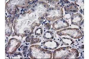Image no. 2 for anti-Catenin (Cadherin-Associated Protein), beta 1, 88kDa (CTNNB1) antibody (ABIN1496890) (CTNNB1 antibody)