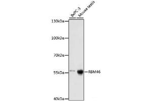 Western blot analysis of extracts of various cell lines using RBM46 Polyclonal Antibody at dilution of 1:1000. (RBM46 antibody)