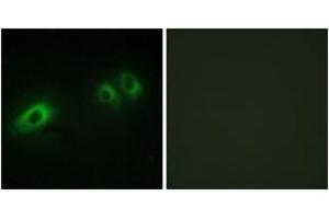 Immunofluorescence analysis of HeLa cells, using LAMB1 Antibody.