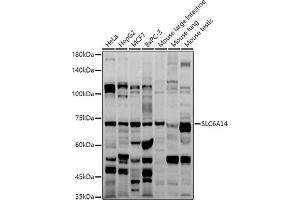 Western blot analysis of extracts of various cell lines, using SLC6 antibody (ABIN6130823, ABIN6148036, ABIN6148037 and ABIN6214884) at 1:1000 dilution. (Slc6a14 antibody  (AA 131-234))