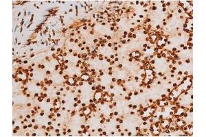 Immunohistochemistry (IHC) image for anti-REL proto-oncogene (c-Rel) (pSer503) antibody (ABIN6255382)