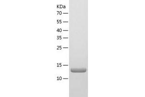 Western Blotting (WB) image for Interleukin 17F (IL17F) (AA 29-161) protein (His tag) (ABIN7123561) (IL17F Protein (AA 29-161) (His tag))