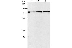 Western Blot analysis of Mouse brain and Human fetal brain tissue, Human brain malignant glioma tissue using KIF3A Polyclonal Antibody at dilution of 1:500 (KIF3A antibody)