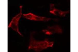 ABIN6266972 staining HT29 cells by IF/ICC. (CYP2J2 antibody  (Internal Region))