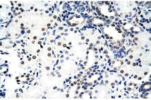 Immunohistochemistry (IHC) image for anti-Nucleolin (NCL) (C-Term) antibody (ABIN2778936)