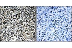 Immunohistochemistry analysis of paraffin-embedded human thymus gland tissue, using CBLN4 Antibody. (CBLN4 antibody  (AA 141-190))