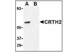 Western blot analysis of CRTH2 in Jurkat cell lysate with at 1 µg/ml in (A) the absence and (B) presence of blocking peptide.