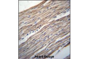HRC Antibody (Center) (ABIN656657 and ABIN2845898) immunohistochemistry analysis in formalin fixed and paraffin embedded human heart tissue followed by peroxidase conjugation of the secondary antibody and DAB staining. (HRC antibody  (AA 277-306))