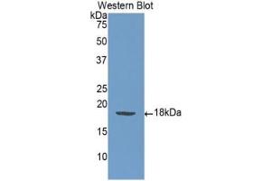 Detection of Recombinant SELP, Human using Monoclonal Antibody to P-Selectin (SELP) (P-Selectin antibody  (AA 198-432))