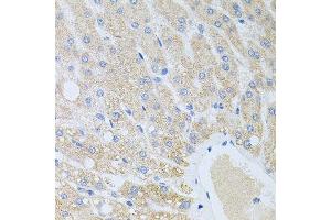 Immunohistochemistry (Paraffin-embedded Sections) (IHC (p)) image for anti-delta-Like 1 Homolog (Drosophila) (DLK1) (AA 83-383) antibody (ABIN6139658)