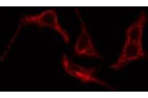 ABIN6276205 staining Hela cells by IF/ICC. (Prostacyclin Receptor antibody  (Internal Region))