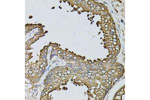 Immunohistochemistry of paraffin-embedded human prostate using MYL1 antibody. (MYL1 antibody  (AA 1-150))