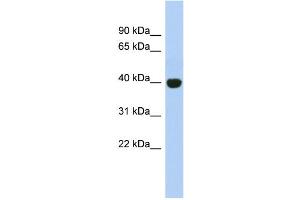 WB Suggested Anti-KIAA1191 Antibody Titration: 0. (KIAA1191 antibody  (Middle Region))