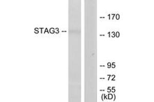 Western blot analysis of extracts from Jurkat cells, using STAG3 Antibody. (STAG3 antibody  (AA 1161-1210))