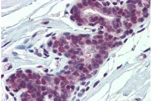 Human Breast: Formalin-Fixed, Paraffin-Embedded (FFPE) (PCBP1 antibody  (AA 208-257))