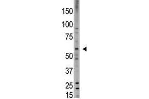 Image no. 1 for anti-Bone Morphogenetic Protein 6 (BMP6) (N-Term) antibody (ABIN357184) (BMP6 antibody  (N-Term))