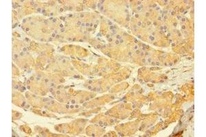 Immunohistochemistry of paraffin-embedded human pancreatic tissue using ABIN7174731 at dilution of 1:100 (PARP11 antibody  (AA 1-245))