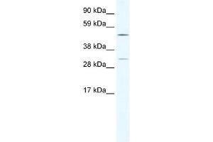 WB Suggested Anti-CAMK4 Antibody Titration:  2. (CAMK4 antibody  (C-Term))