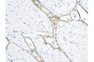 IHC analysis of ANXA3 using anti-ANXA3 antibody (ABIN6719269). (Annexin A3 antibody  (AA 23-323))