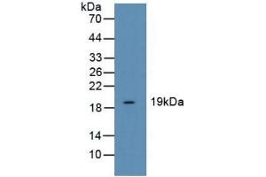 Detection of CFL1 in Human Liver Tissue using Polyclonal Antibody to Cofilin 1 (CFL1) (Cofilin antibody  (AA 3-161))