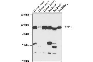 Western blot analysis of extracts of various cell lines, using CPT1C antibody (ABIN6130131, ABIN6138980, ABIN6138981 and ABIN6217987) at 1:3000 dilution.