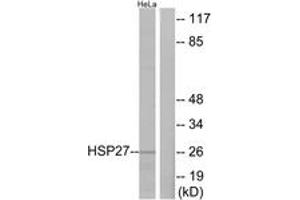 Western blot analysis of extracts from HeLa cells, treated with Ca2+, using HSP27 (Ab-82) Antibody.