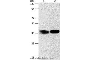 Western blot analysis of Hela cell and mouse kidney tissue, using ADPRHL2 Polyclonal Antibody at dilution of 1:500 (ADPRHL2 antibody)