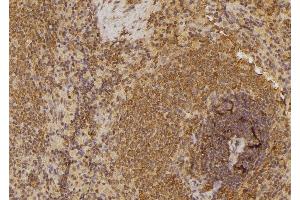 ABIN6258774 and ABIN6274538 at 1/100 staining Rat spleen tissue by IHC-P. (EPH Receptor A6 antibody  (C-Term))