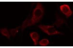 ABIN6275810 staining Hela cells by IF/ICC. (TBXAS1 antibody  (N-Term))