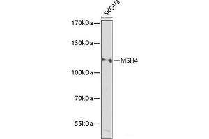 Western blot analysis of extracts of SKOV3 cells using MSH4 Polyclonal Antibody at dilution of 1:1000.