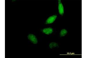 Immunofluorescence of purified MaxPab antibody to ELF2 on HeLa cell.