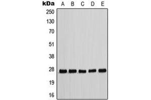Western blot analysis of p27 Kip1 (pT198) expression in HEK293T EGF-treated (A), MCF7 (B), NIH3T3 (C), Raw264. (CDKN1B antibody  (C-Term, pSer198))