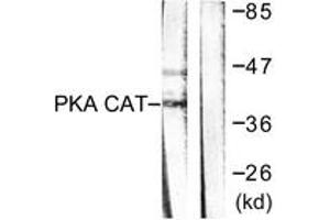 Western blot analysis of extracts from mouse brain cells, using PKA alpha/beta CAT (Ab-197) Antibody. (PKA alpha/beta Cat (AA 166-215) antibody)