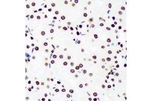 Immunohistochemical analysis of DDX41 staining in rat kidney formalin fixed paraffin embedded tissue section. (DDX41 antibody)