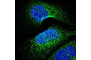 Immunofluorescent staining of human cell line U-2 OS with PARP4 polyclonal antibody  shows positivity in cytoplasm. (PARP4 antibody  (AA 247-392))