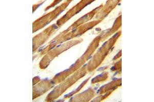 SLC16A10 Antibody (C-term) (ABIN657159 and ABIN2846293) immunohistochemistry analysis in formalin fixed and paraffin embedded human skeletal muscle followed by peroxidase conjugation of the secondary antibody and DAB staining.