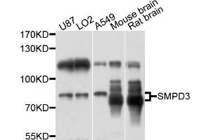 Western blot analysis of extracts of various cell lines, using SMPD3 antibody (ABIN6003882) at 1/1000 dilution. (SMPD3 antibody)