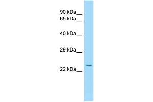 Western Blotting (WB) image for anti-Interleukin 15 Receptor, alpha (IL15RA) (N-Term) antibody (ABIN2789521) (IL15RA antibody  (N-Term))