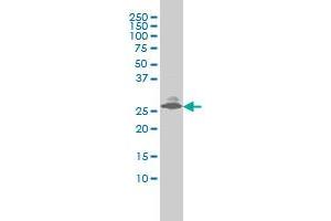 EDN3 monoclonal antibody (M01), clone 2A6-2A4 Western Blot analysis of EDN3 expression in LNCaP . (Endothelin 3 antibody  (AA 1-238))