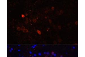 Immunofluorescence analysis of Mouse brain using CALB2 Polyclonal Antibody at dilution of 1:100. (Calretinin antibody)