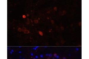 Immunofluorescence analysis of Mouse brain using CALB2 Polyclonal Antibody at dilution of 1:100. (Calretinin antibody)