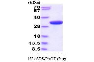 SDS-PAGE (SDS) image for Ribosomal Protein S6 Kinase, 70kDa, Polypeptide 1 (RPS6KB1) (AA 1-525) protein (His tag) (ABIN5855088)