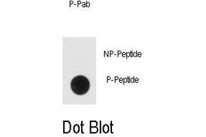 Image no. 1 for anti-Enolase 2 (Gamma, Neuronal) (ENO2) (pTyr236) antibody (ABIN358515) (ENO2/NSE antibody  (pTyr236))