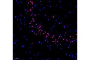 Immunofluorescence (Paraffin-embedded Sections) (IF (p)) image for anti-RNA Binding Motif Protein 8A (RBM8A) antibody (ABIN7075478)