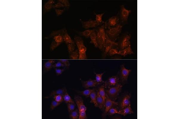 Dystrophin antibody  (AA 346-635)