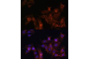 Immunohistochemistry of paraffin-embedded rat heart using Dystrophin Rabbit pAb (ABIN1679546, ABIN3015473, ABIN3015474 and ABIN6218357) at dilution of 1:25 (40x lens). (Dystrophin antibody  (AA 346-635))