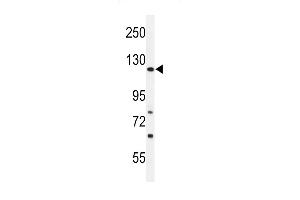 (LEFT)Western blot analysis of ARHG Antibody (C-term) (ABIN651188 and ABIN2840117) in Ramos cell line lysates (35 μg/lane). (ARHGAP30 antibody  (C-Term))