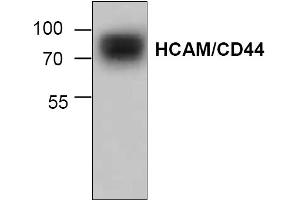 Image no. 1 for anti-CD44 (CD44) antibody (ABIN155127) (CD44 antibody)
